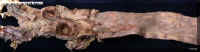 aortaatero1.jpg (47194 bytes)