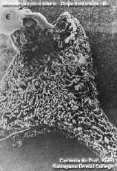 microcirpolpa.jpg (49872 bytes)
