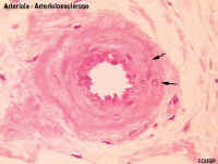 arteriolA.jpg (30256 bytes)
