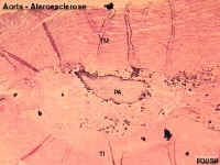 calaortaA.jpg (38240 bytes)