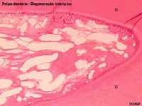 deghidr2A.jpg (37430 bytes)
