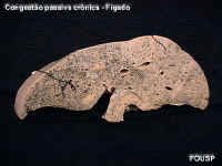 figadohiperem1.jpg (44784 bytes)