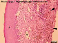 hemos1A.jpg (47914 bytes)
