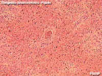 hipfig2.jpg (76404 bytes)