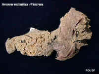 necroseenzpan1.jpg (41969 bytes)