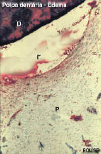 poled2.jpg (39508 bytes)