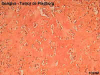 tpindcogA.jpg (43010 bytes)